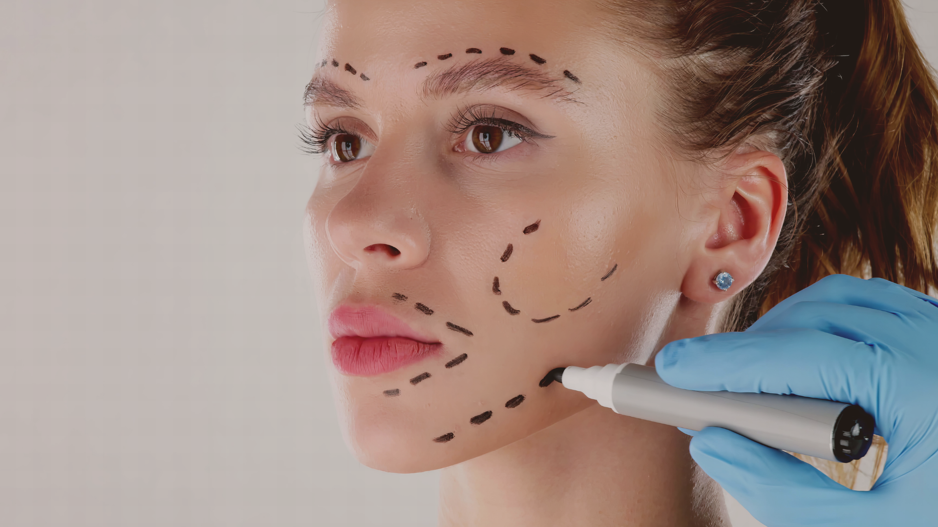 O que é Harmonização Facial?