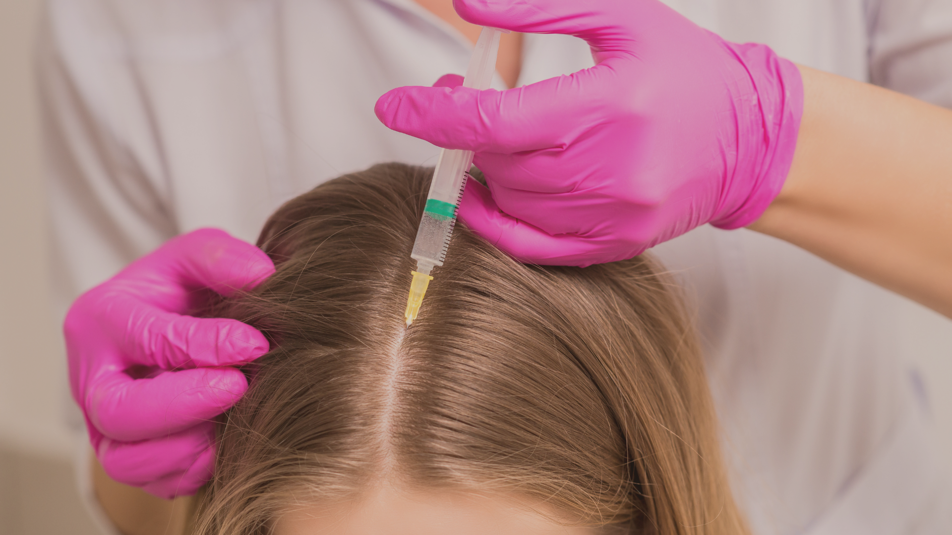 O que é Mesoterapia Capilar?