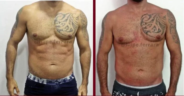 Resultado antes e depois
